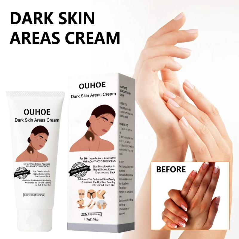 Black Acanthus Skin Repair Cream Body Lightening Joint Moisturizing Whitening Underarm Private Parts Removal Dark Spots Cream