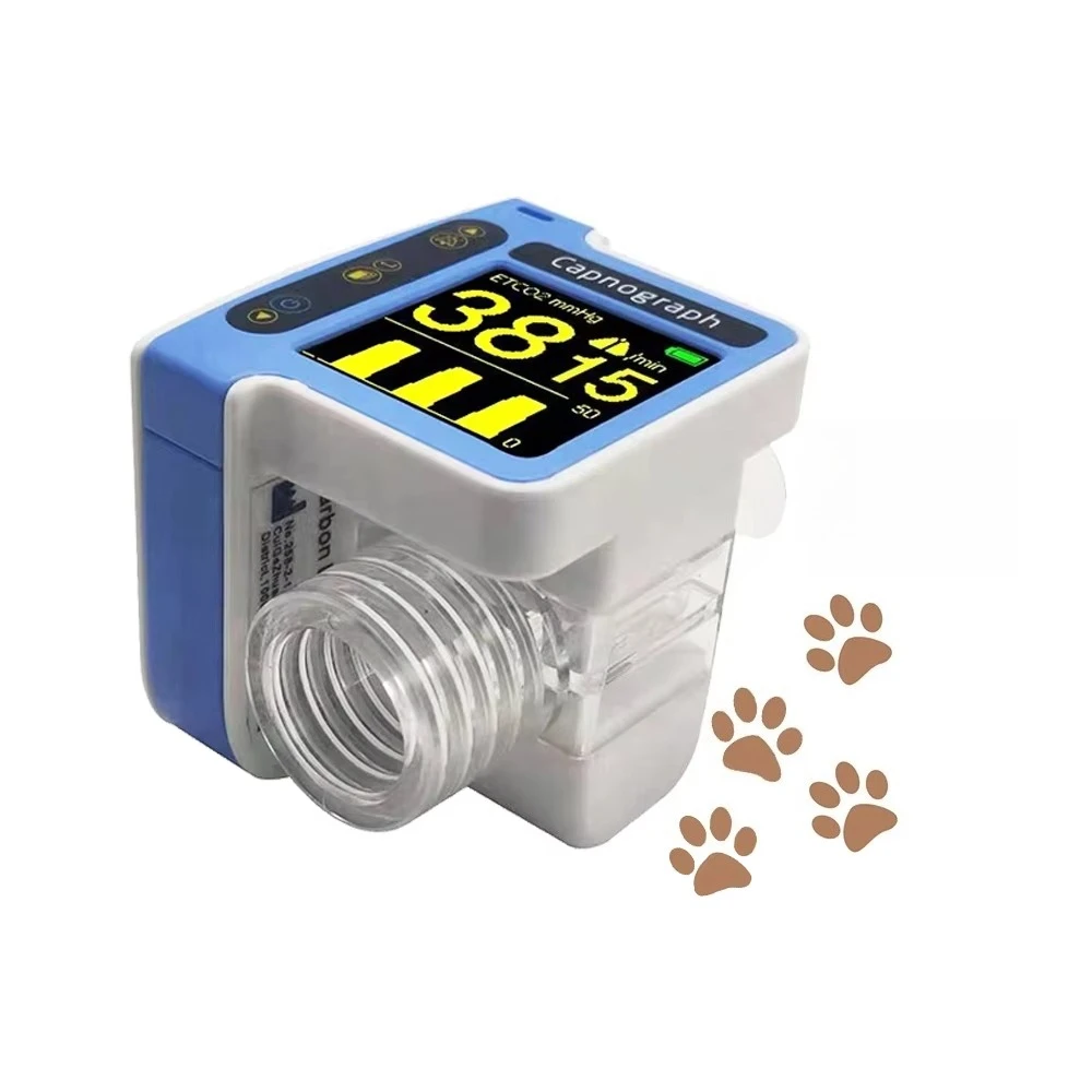 

BPM-ETCO2-1 Factory Supply Quality Assurance Real-time Portable Capnography ETCO2