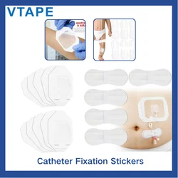 Foley Catheter stabilization Device, Catheter Urinary Leg Bag Legband Holder, Urinary Tube Fixing Sticker, (Pack of 60)