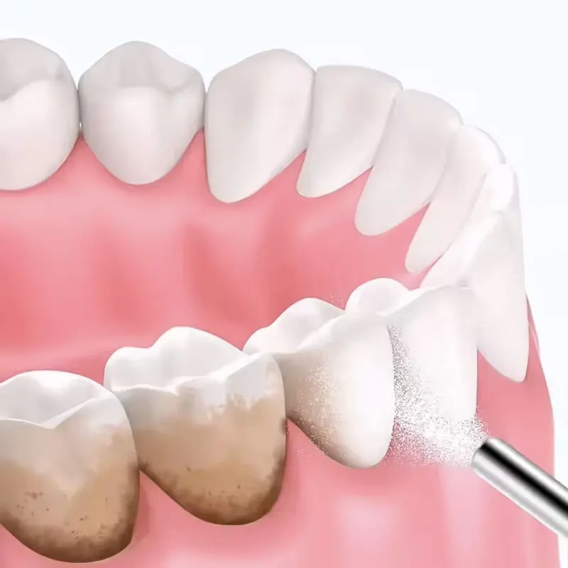 130g Dental Sandblasting Powder Teeth Whitening Powder Sandblasting Machine Material Fruit Flavor Strawberry Lemon view 4