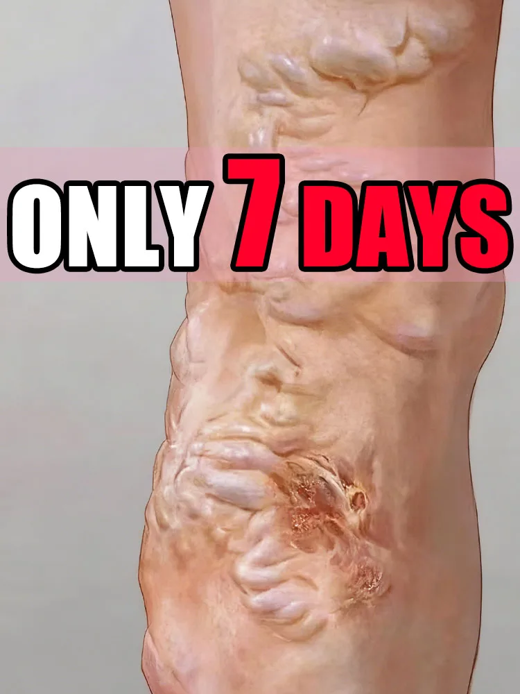 2025 핫셀링 2세대: 7일 안에 당신의 문제에 작별 인사를 하세요