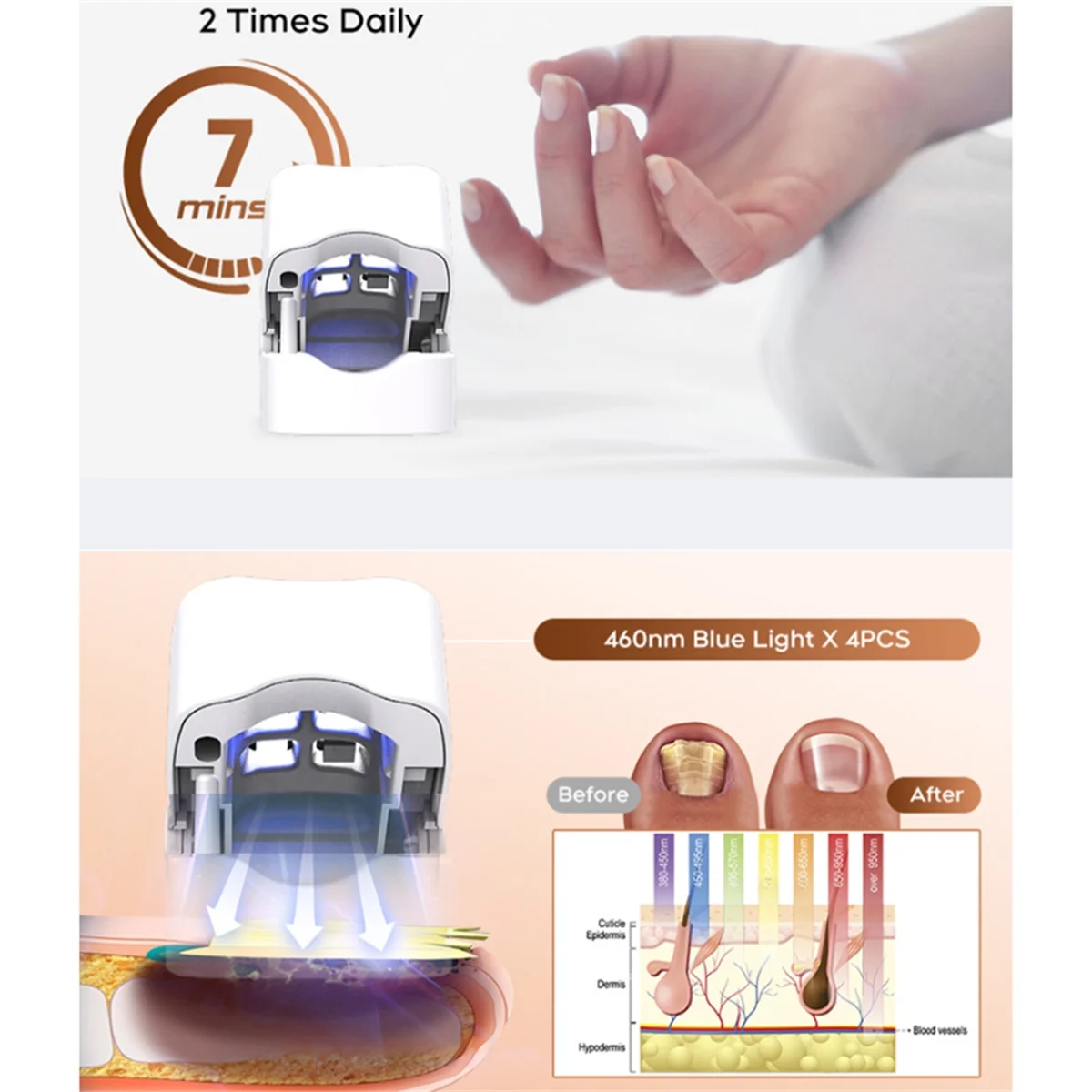 BABQ Luz de limpieza de hongos de uñas con dispositivo de pantalla LED Tratamientos de hongos de uñas para luz de onicomicosis para uñas de los pies A