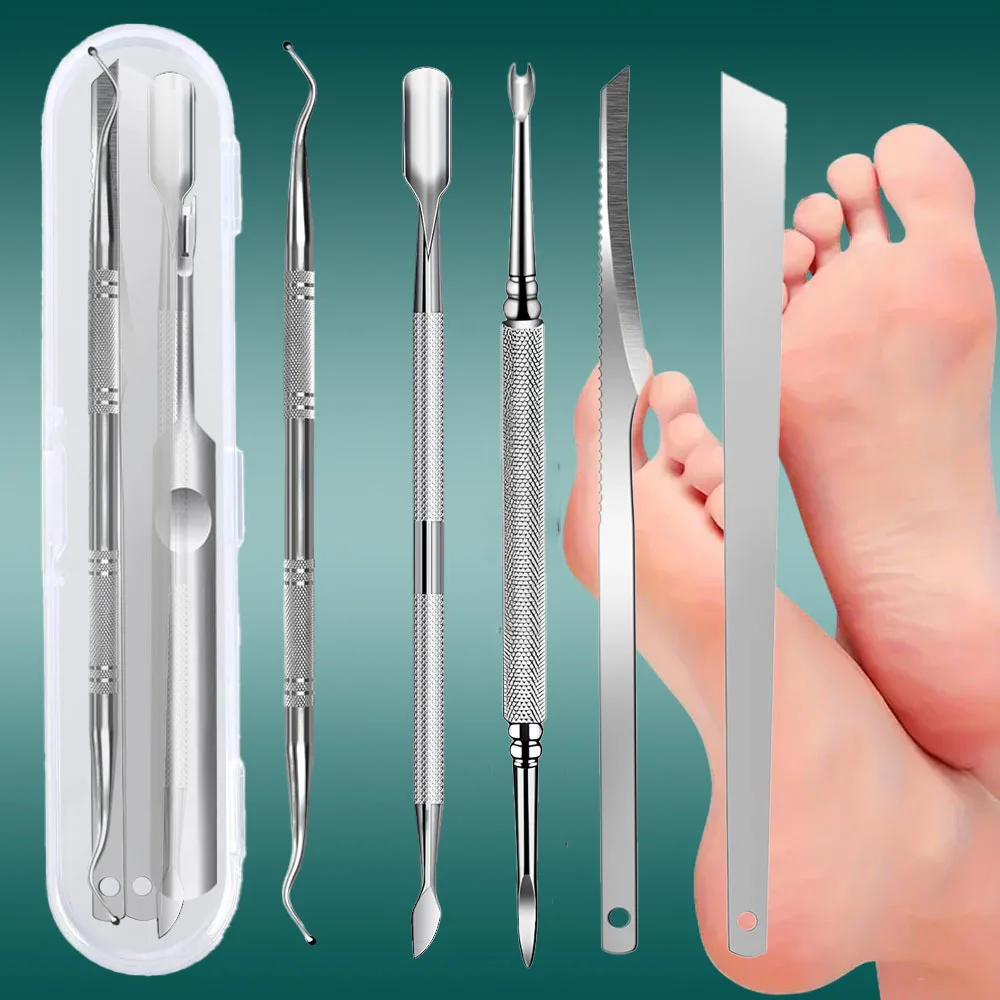 5pcs Stainless Steel Foot Care Kit,Including Foot File,Pumice Stone,Exfoliation Tool,Dead Skin Remover And Nail Edge Maintenance