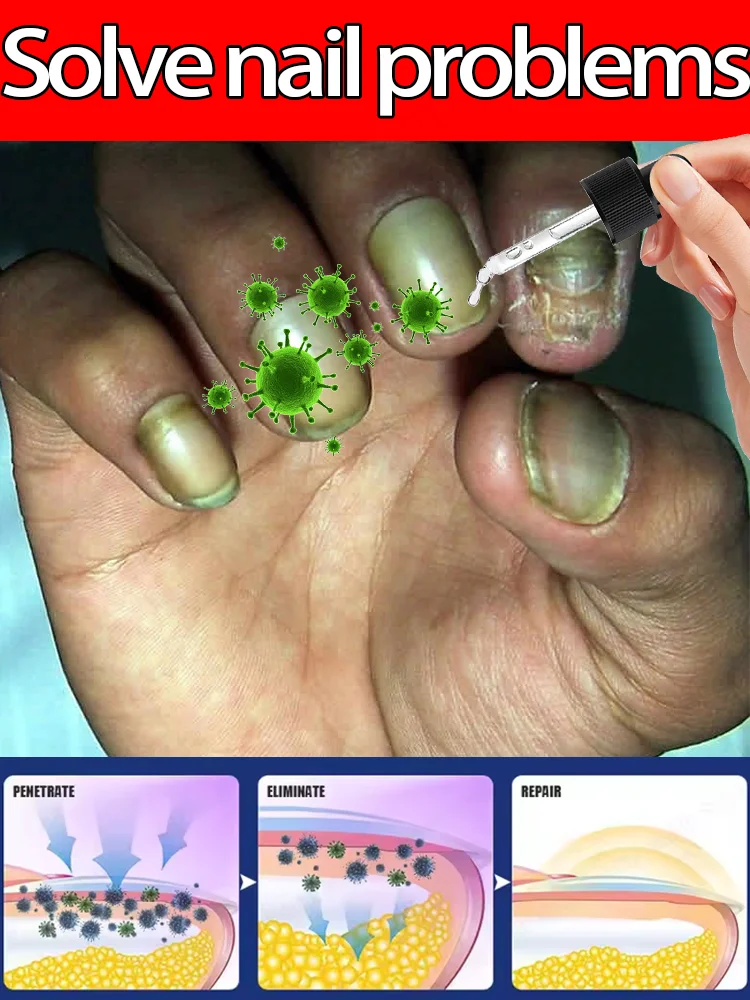 

ᵈᵉᶜᵏ on "Aurora Healing": Using plant energy to dissolve fungal shadows