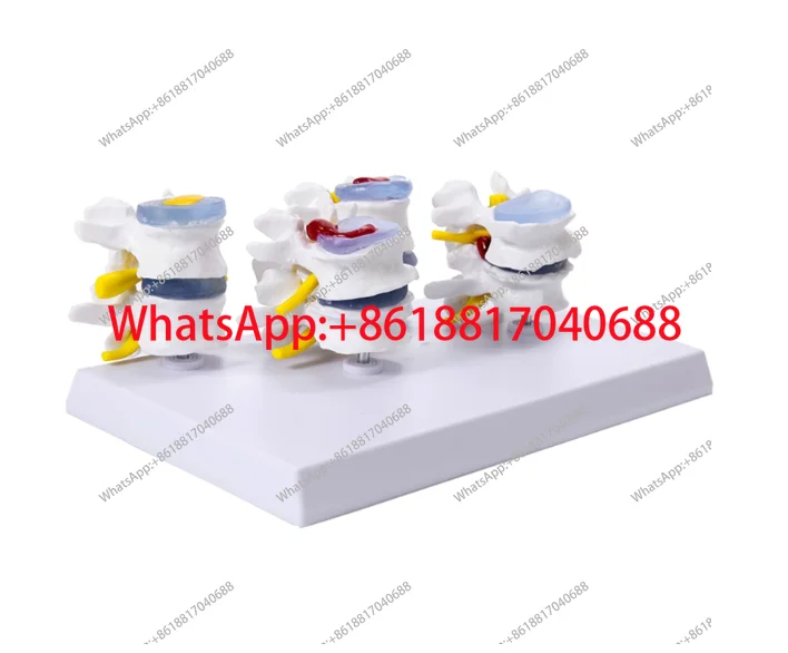 Human Anatomy Skeleton Spine 4-Stages Lumbar Vertebral Model Brain Skull Traumatic Teaching Supplies