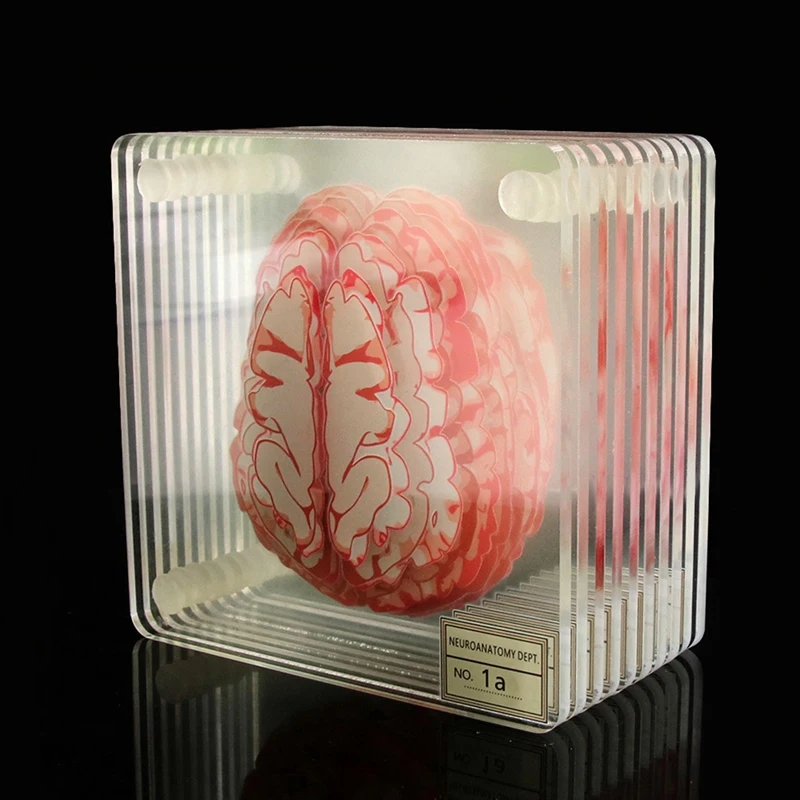 Brain Specimen Coasters Set 3D Organ Brain Artwork Brain Slices Square Acrylic Drinks Table Coaster