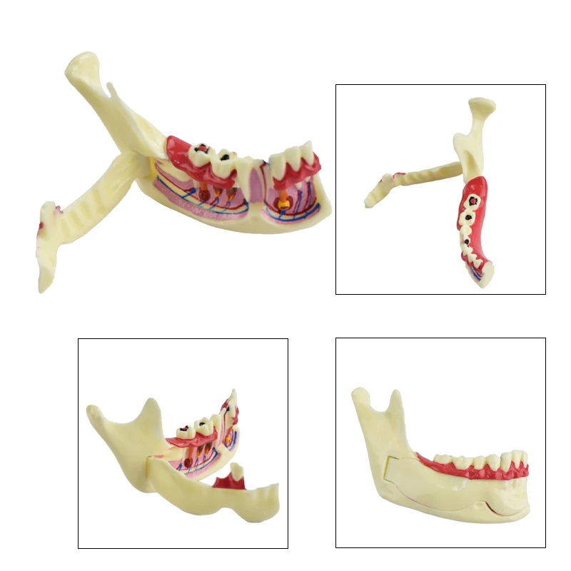 

1Pcs Orthodontic Braces Dental Mandibular Tissue Teeth Demonstration Anatomical Model Patient Study Teach Decomposition Model