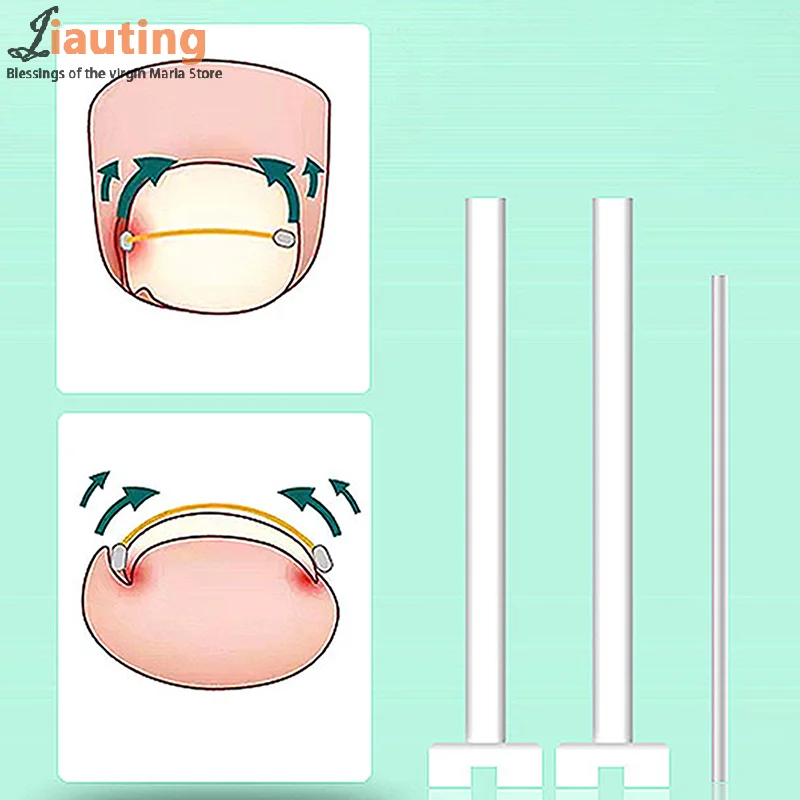 نام أظافر مصحح أداة ، باديكير المهنية ، استعادة تضمين ، تو علاج الأظافر ، استقامة كليب ، هدفين مع الغراء