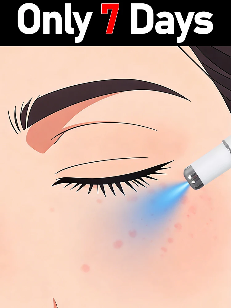 

Средство для удаления плоских и нитевидных бородавок, ручка-лазер для удаления бородавок на шее и лице, устраняет мясистые выступы и пятна.