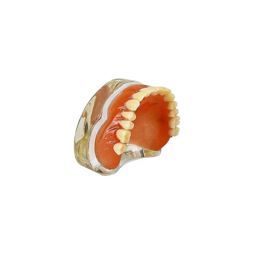 Dental Teeth Model 4 Implant Restoration Models For Patient Education Demo Removable Bridge  Dentistry Upper Overdenture Model