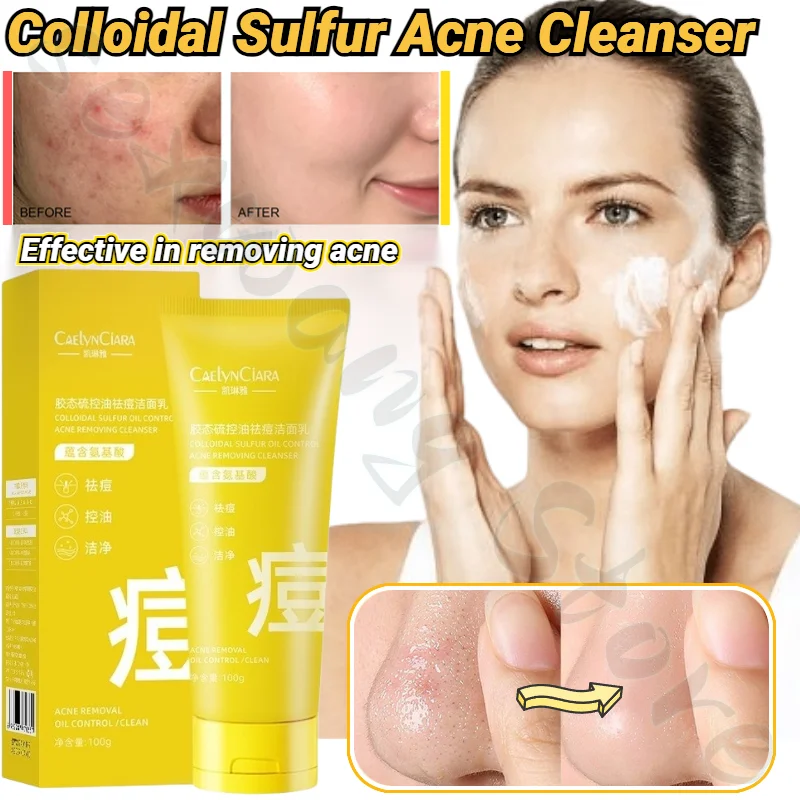 

Colloidal Sulfur Acne Cleanser 100g Deep Cleansing Oil Control Moisturizing Plant Acne Remover Blackhead Cleaning Pore Cleanser