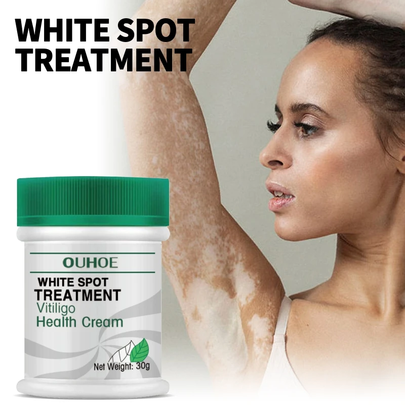 Efficient White Spot Remover Cream 30g Herbal Extract Skin Repair Cream Remove Pigment Repair Body Face Care Cre