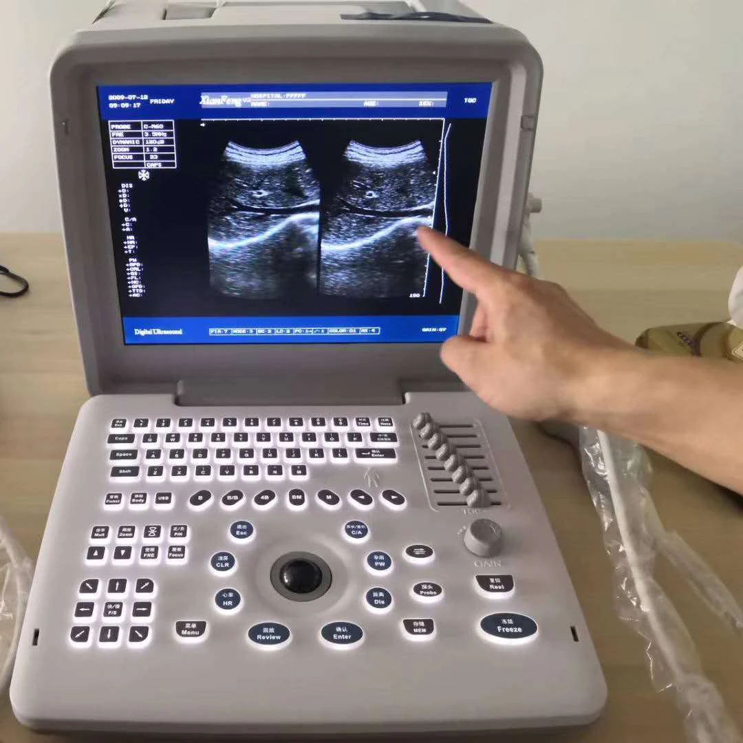 Various Good Quality XF300 VET Full Digital LED Livestock Portarable Hand Held Vet Ultrasound