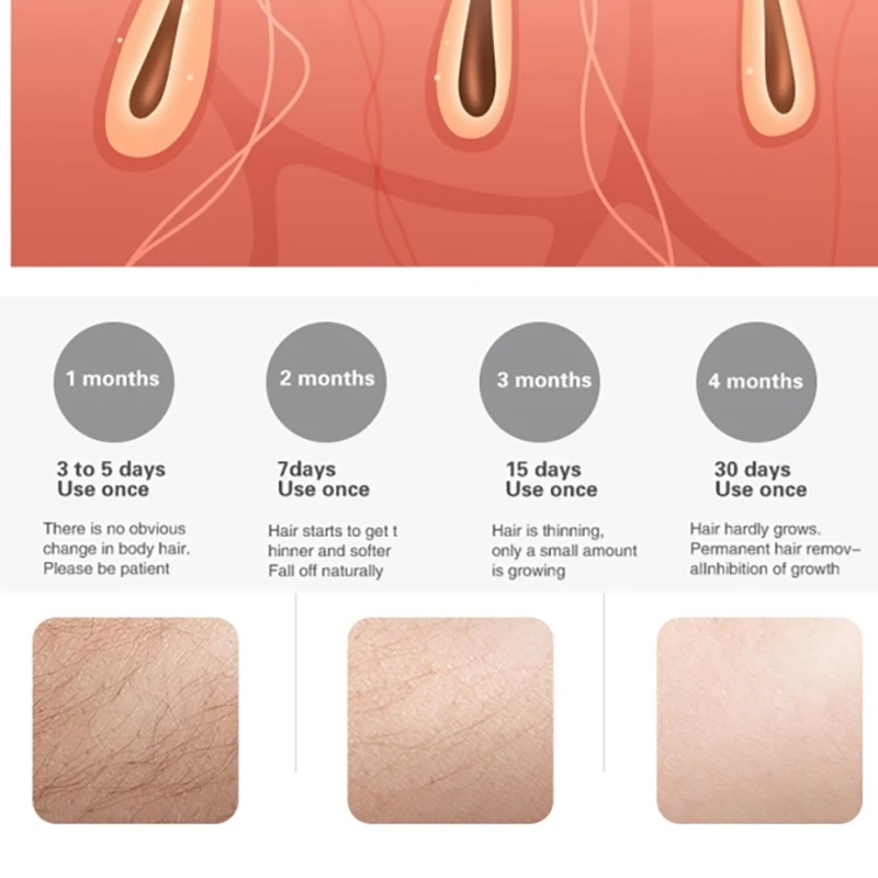 B83B-EU Plug IPL Hair Removal For Women And Men Permanent Painless Hair Removal System 300,000 Flashes Hair Remover Treatment
