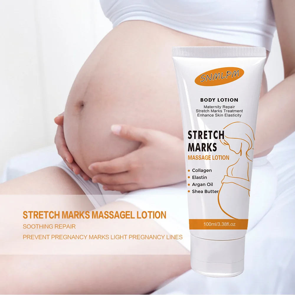 100ml Stretch Mark Repair Cream Firming and Lightening Obesity Postpartum Stretch Marks Stretch Mark Cream Free Shipping