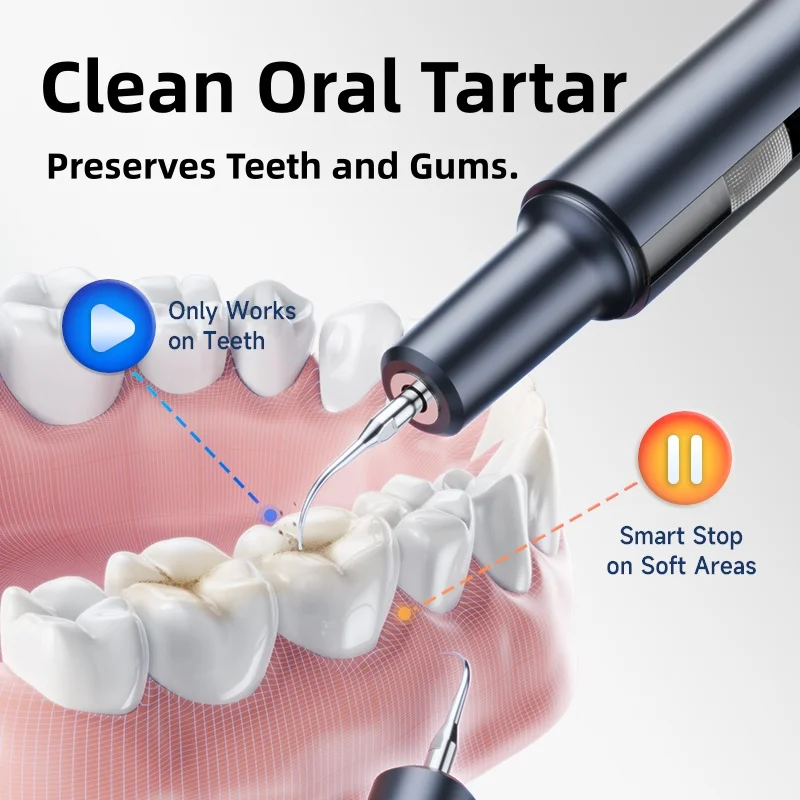 CURVY MOON T7 Elektrische Zahnaufhellung Zahnstein Scaler Plaque Kaffee Fleck Zahnstein Entfernung Hochfrequenz Sonic Zahnbürste