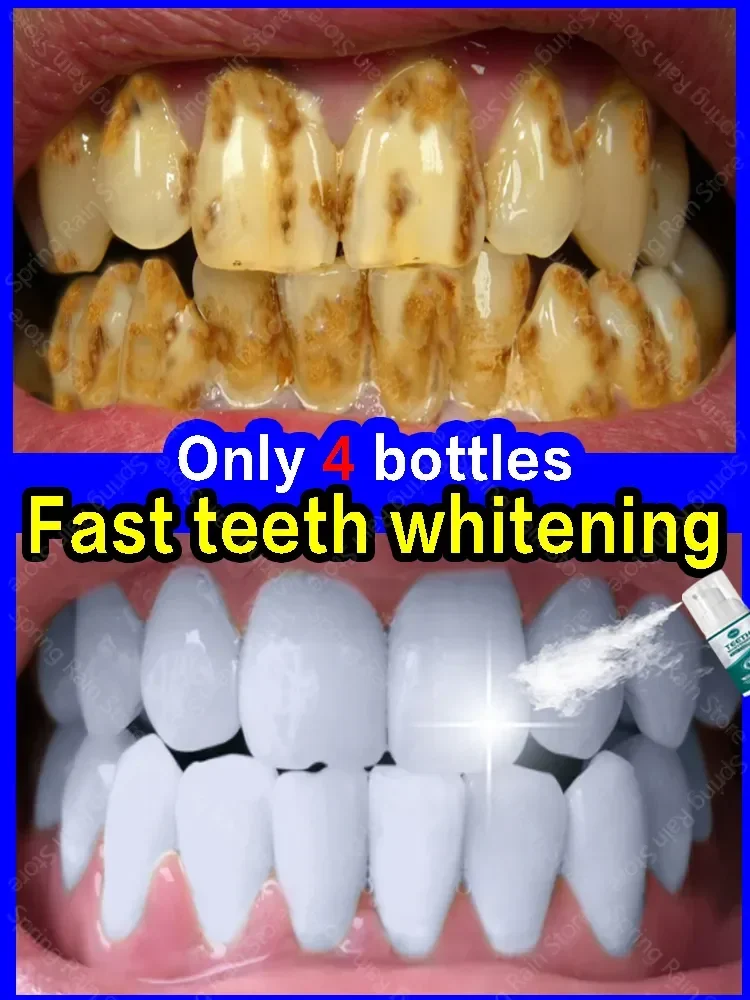 

Quick And Deep Cleaning Of Teeth To Coffee Stains