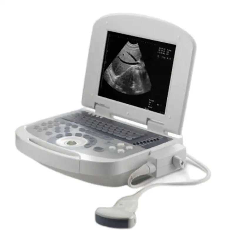 

New type laptop color Doppler 128 elements real time factory direct ultrasound machine