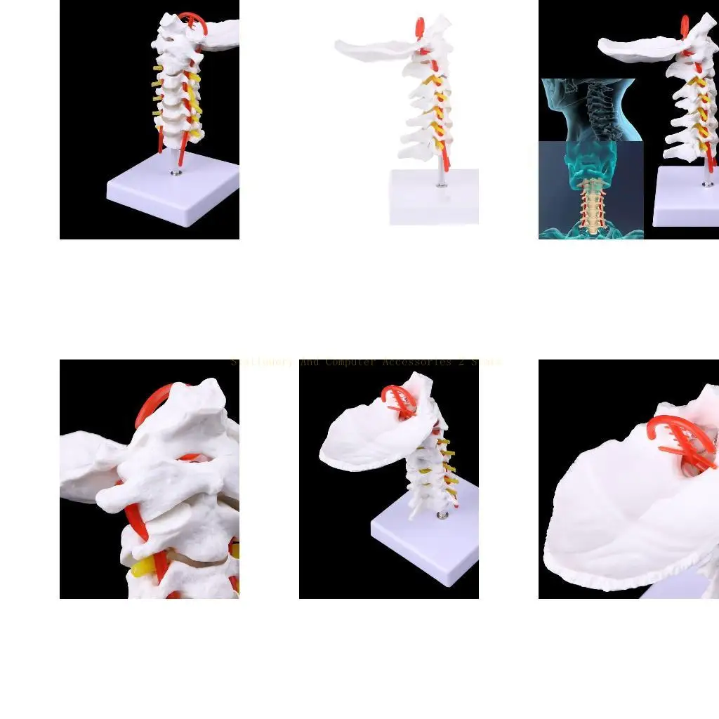 

Шейный позвонок, артерия, позвоночник, спинномозговые нервы. Анатомическая модель в натуральную величину.