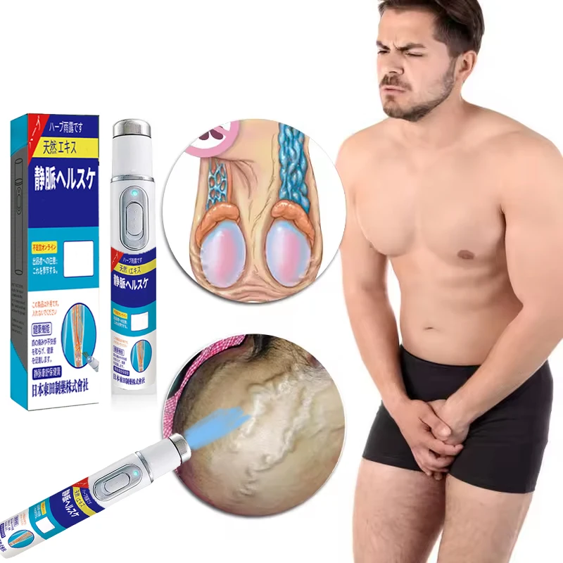 Generacja Laserowa Trzecia na Żylaki - Laserowy Punktator do Leczenia Eliminuje Zapalenie Naczyń i Żylaków, Łagodzi Ból Pajączkowych Nóg