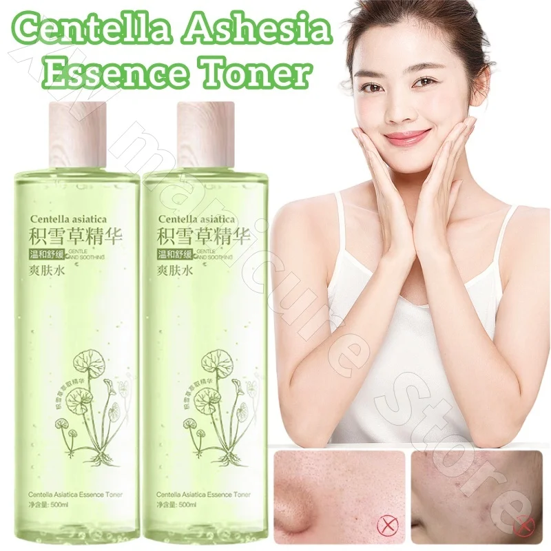 Centella Ashesia Solid Toner Repair Sensitive Skin Removes Red Bloodshots and Lightens Acne Marks Replenishes Hydrating 500ml