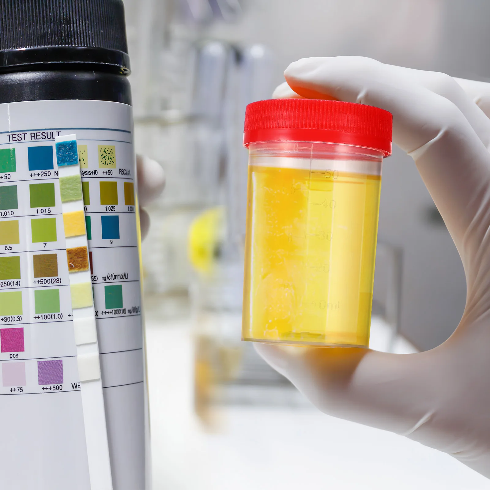 10 Stück 60 ml Urin-Probenbecher, Probentöpfe, Probensammlerbehälter, Messflasche mit Deckel, zufällige Farbe