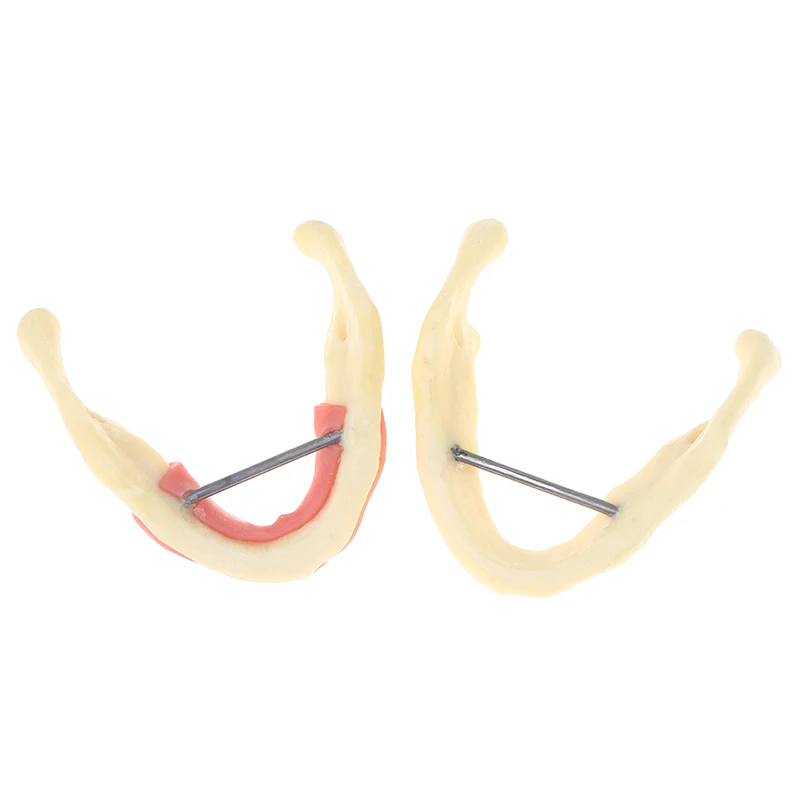 SN Dental Treatment Model Anatomy Of Gums Gingiva Mandible Tissue Model Dentist Teach Study Demonstration Teeth Model Dental Lab
