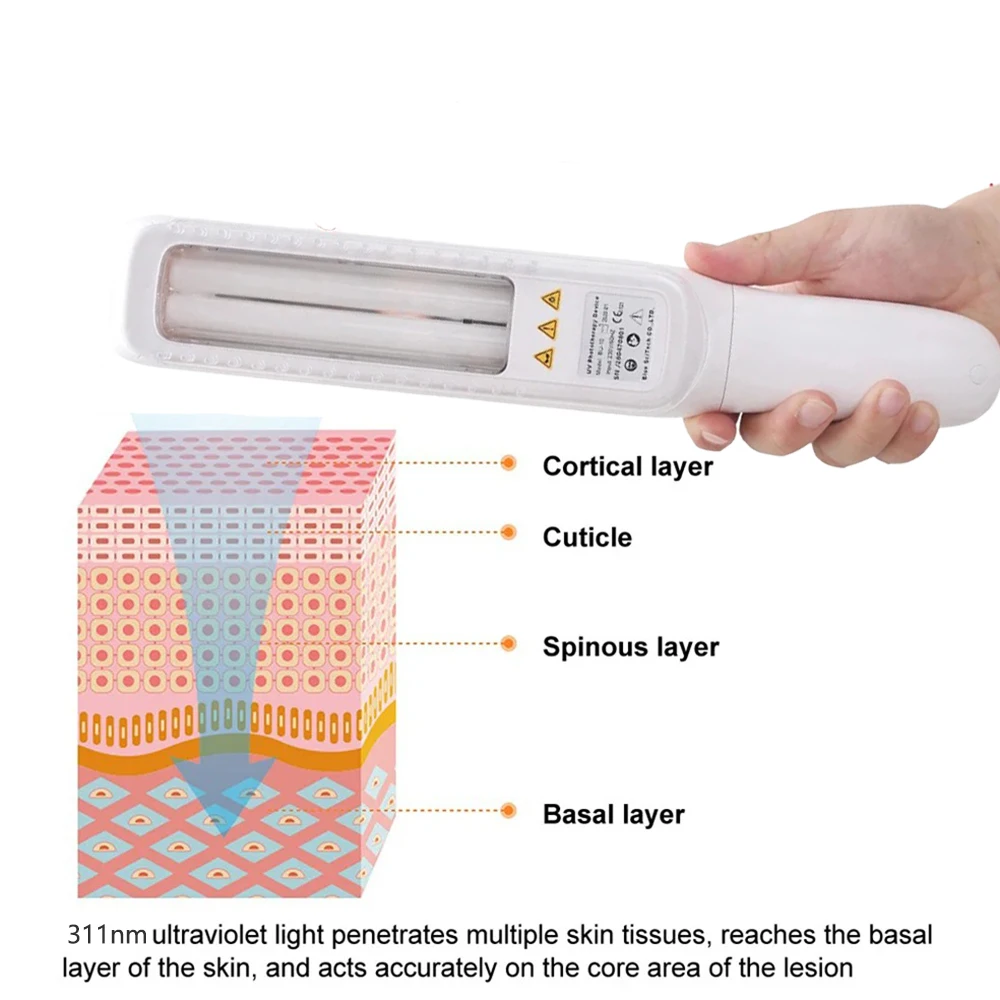 311nm UVB ultrafioletowy przyrząd do fototerapii leczenie bielactwa lampa UV laser do terapii bielactwo łuszczyca choroby skóry