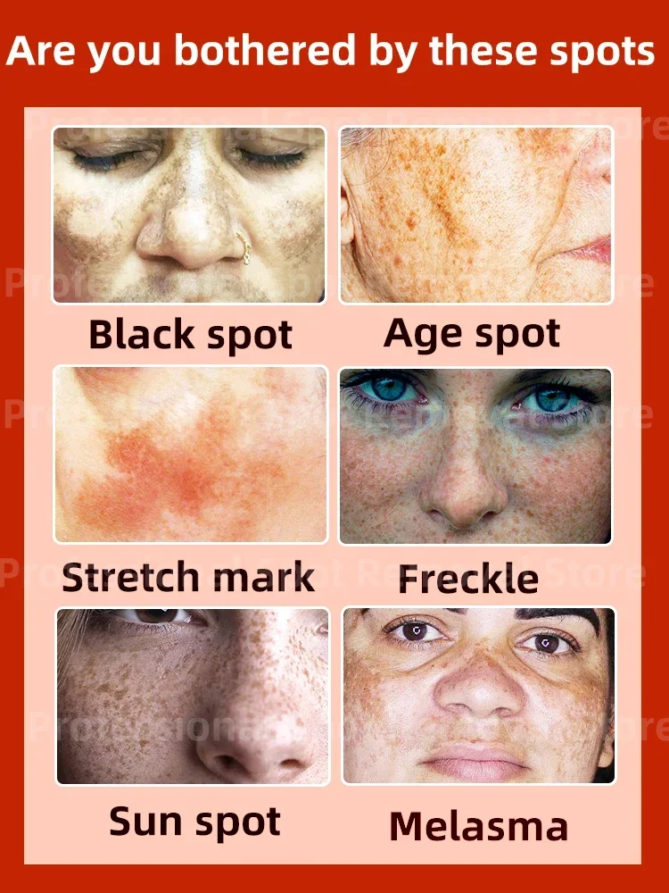 Reduce pigmentation