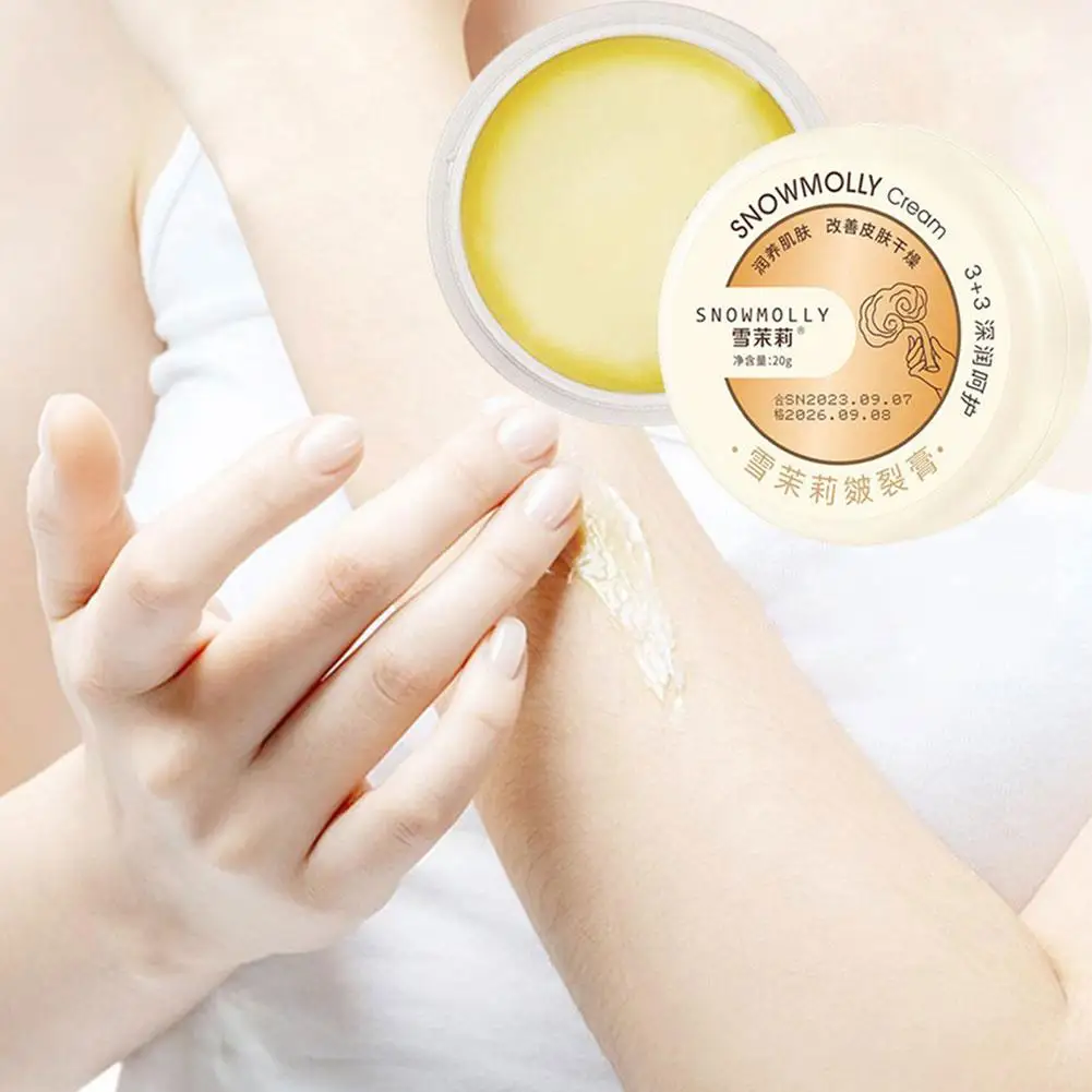 Crema antigrietas para pies, crema reparadora para talón agrietado, eliminación de piel muerta, cuidado de manos y pies agrietados, Spa, 20g, 1 a 10 unidades