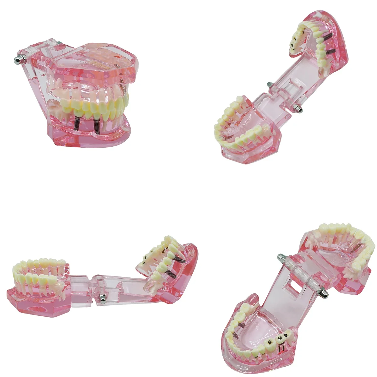 Thumbnail 3 - #10 Dental Teaching Models List of Top Picks