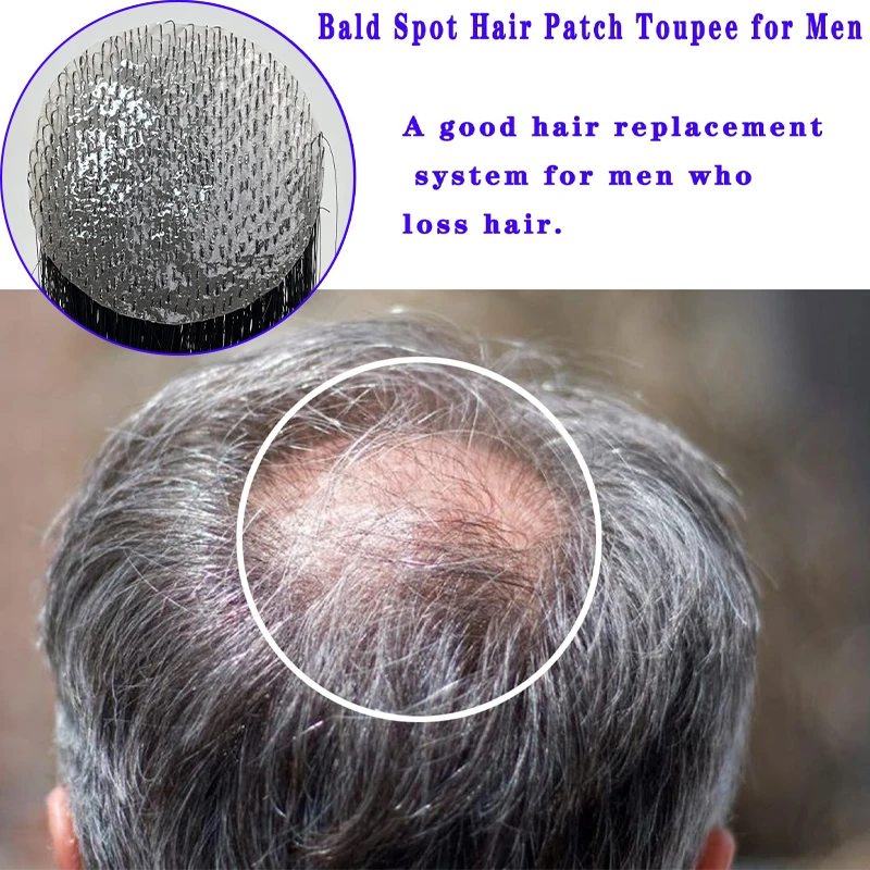 Parche para cicatrices de postizo superior de la cabeza, peluquín de cabello humano 100%, parche de cicatriz Circular Invisible sin costuras de piel ultrafina de PU para hombres