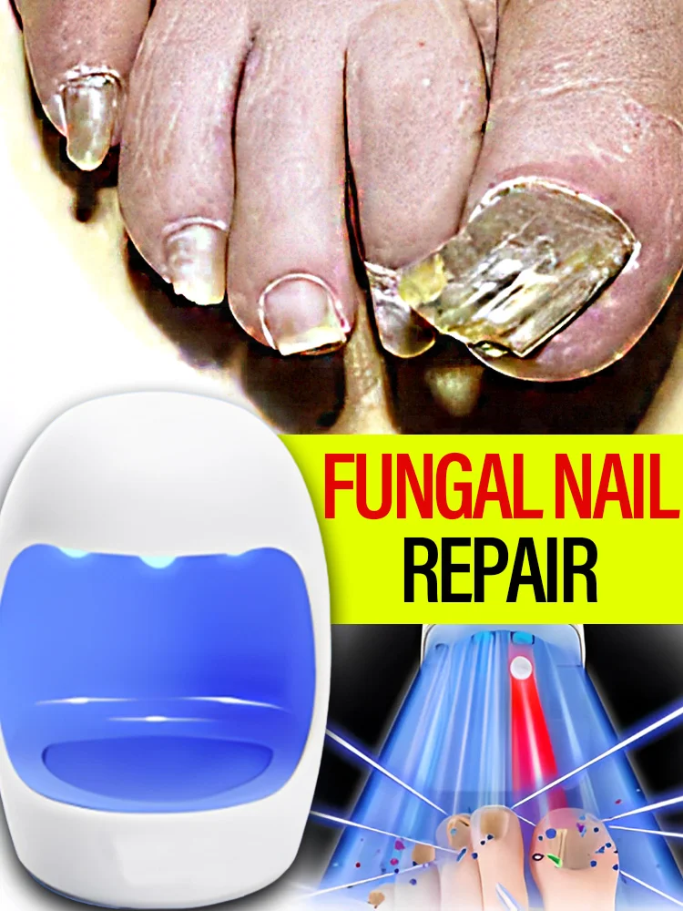 Rapidly Nail repair and promote blood circulation