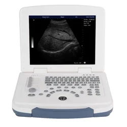 b/w ultrasound machine digital  for obstetrics and gynaecology