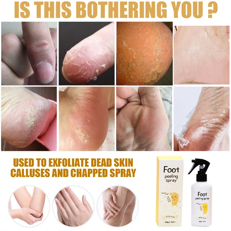 Foot Exfoliating Spray Anti-Drying Crack Removal Dead Skin Calluses Feet Whiten Care Liquid Peeling Heel Enhancer Nail Pedicure