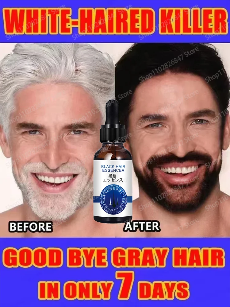 

Black hair growth from the source,anti-white hair growth liquid roots grow black essence care grows out the growth of white