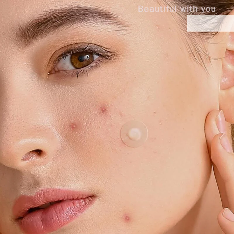 

Bear Design Spot Stickers in Bulk, 90/180/360/720PCS Waterproof Cartoon Animal Pimple Patches for Acne Treatment