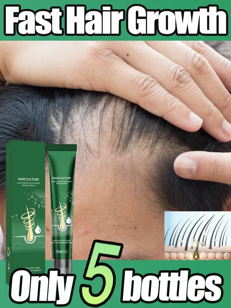 Fast Hair Growth Essential oil Promoter aHair Loss Hereditary Seborrheic Alopecia Treatment For aHair Growth Essence Natural