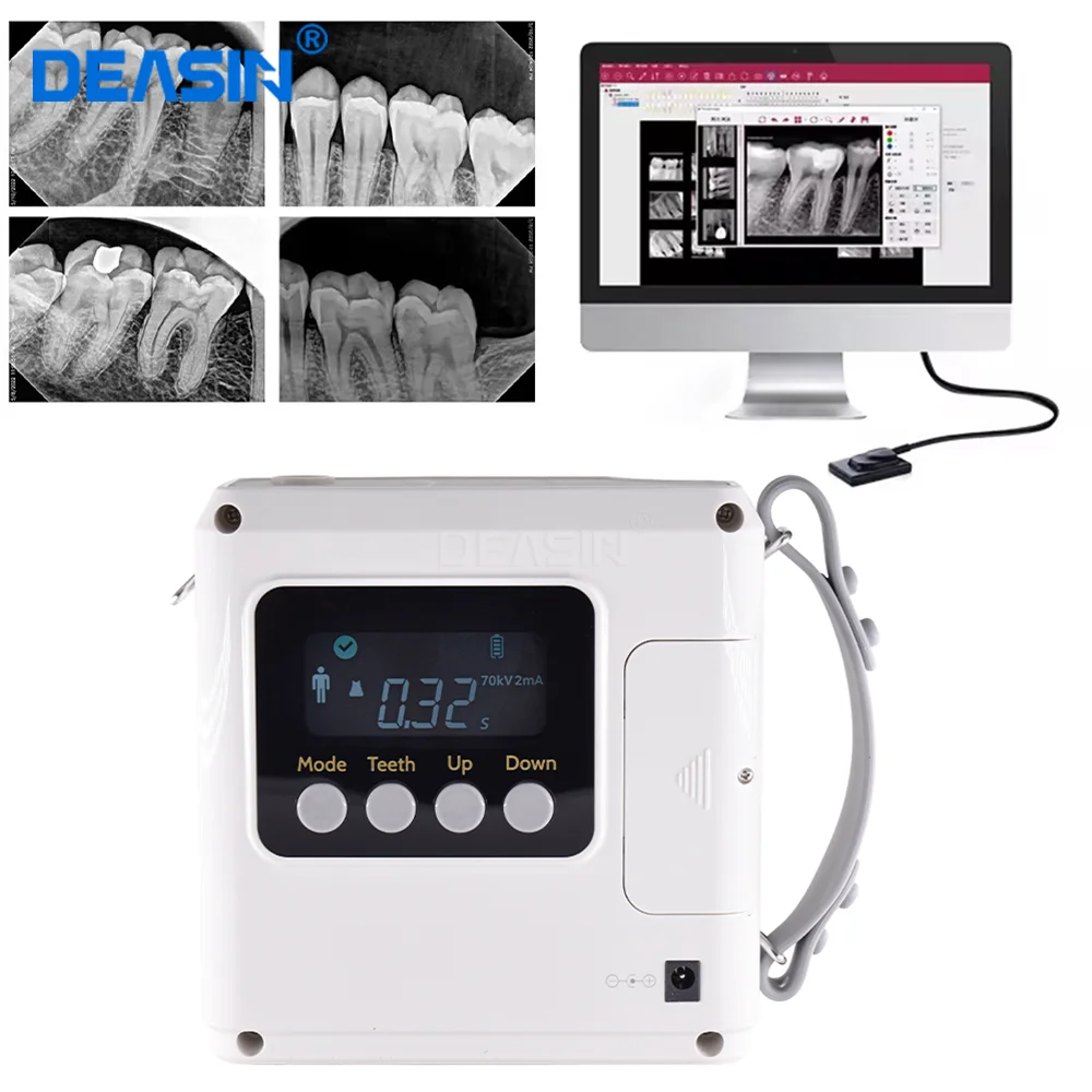 70KV High Frequency Dental X-Ray Unit Low Radiation Portable Dental X Ray Machine Imaging System XRays