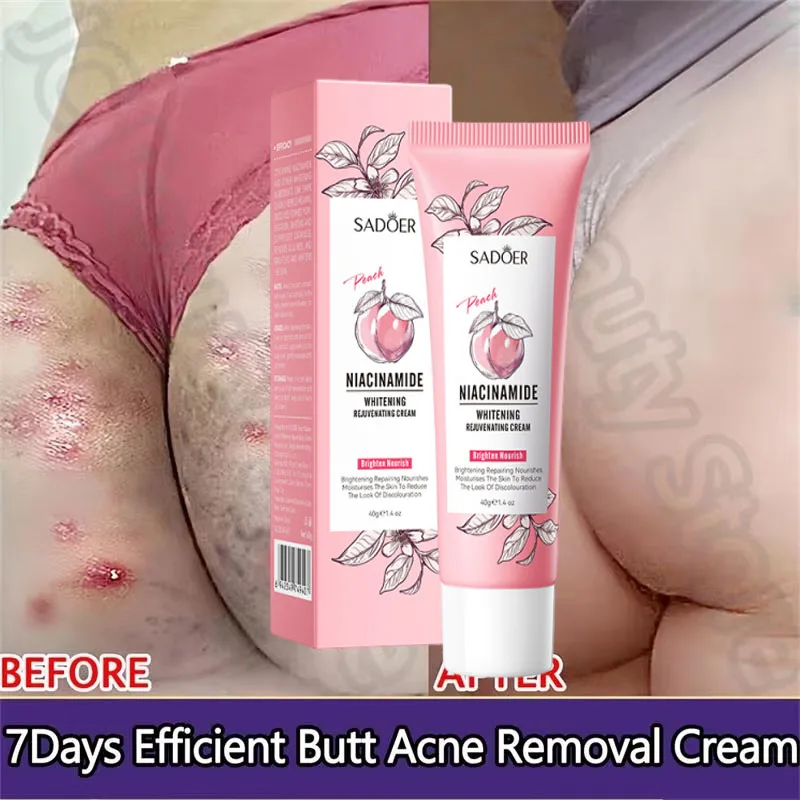 Crema reparadora de queratosis Pilaris, eliminación exfoliante, limpieza de la piel de pollo, manchas de acné, hidratante, cuidado de la piel corporal suave