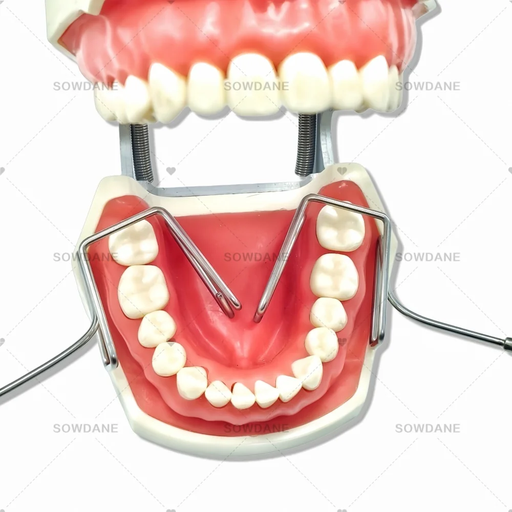 J Lab الفولاذ المقاوم للصدأ فاصل اللغة اللسان المعزل الشفاه الخد المعزل الشفاه الخد فاصل الكامشات أفضل أداة