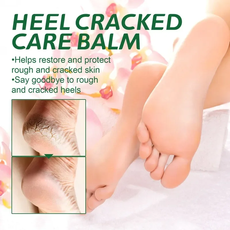 Sdotter New Cracked heel care cream Repair peeling Anti-drying Crack foot moisturizing Removal Calluses Bad Skin Hand feet care