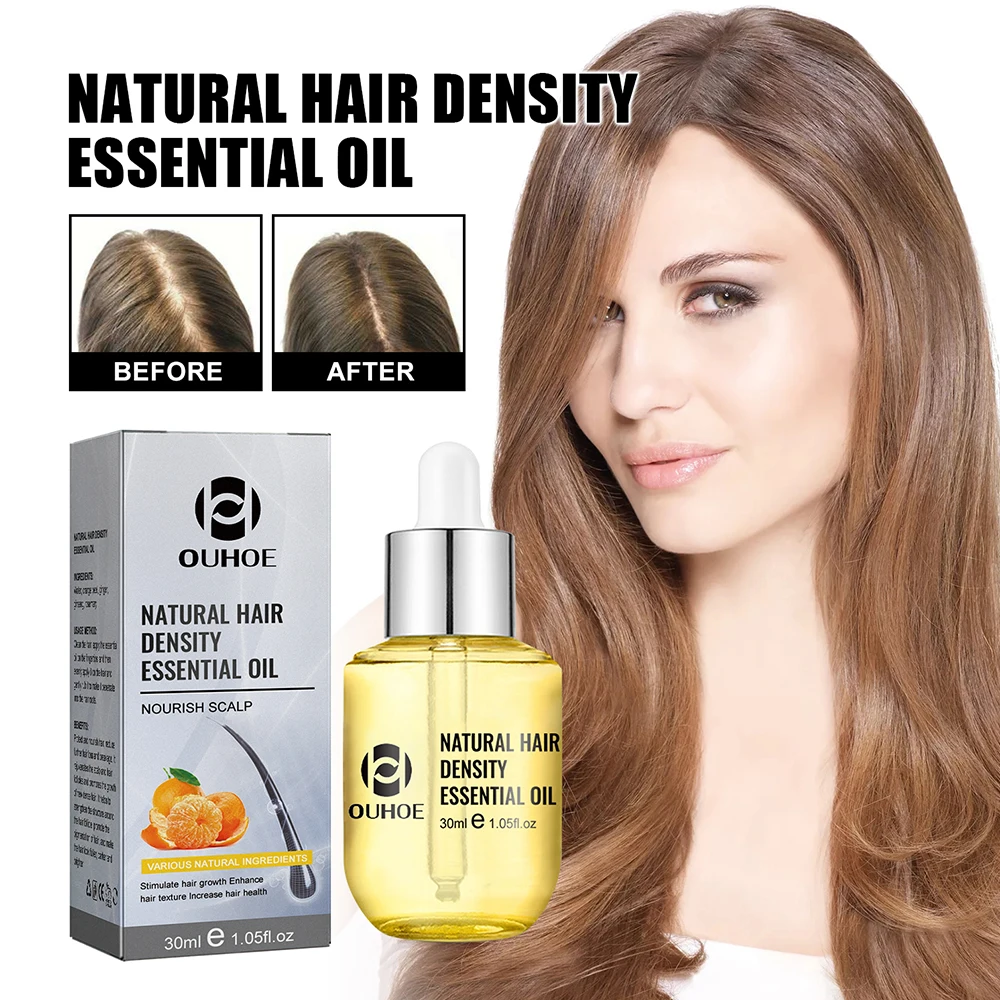 헤어 증모 에센셜 오일 30ml 헤어 케어 에센스 모발 - Hair Care Ginseng 리뷰 및 가격