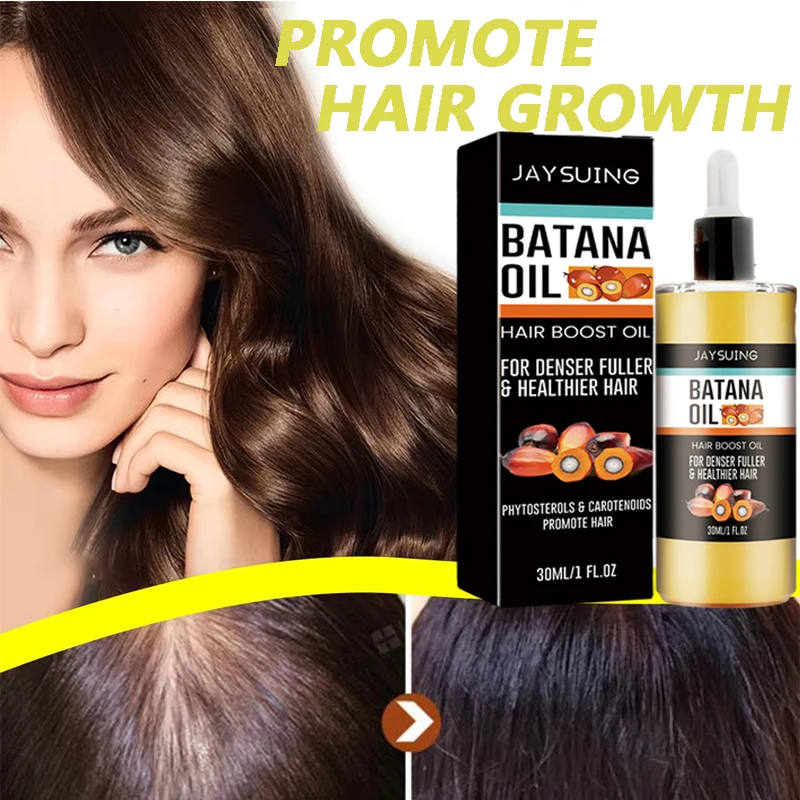 

Набор для быстрого роста волос Батана Oil Traction Alopecia Маска для волос против выпадения волос Масло для роста волос Лечение облысения Уход за волосами