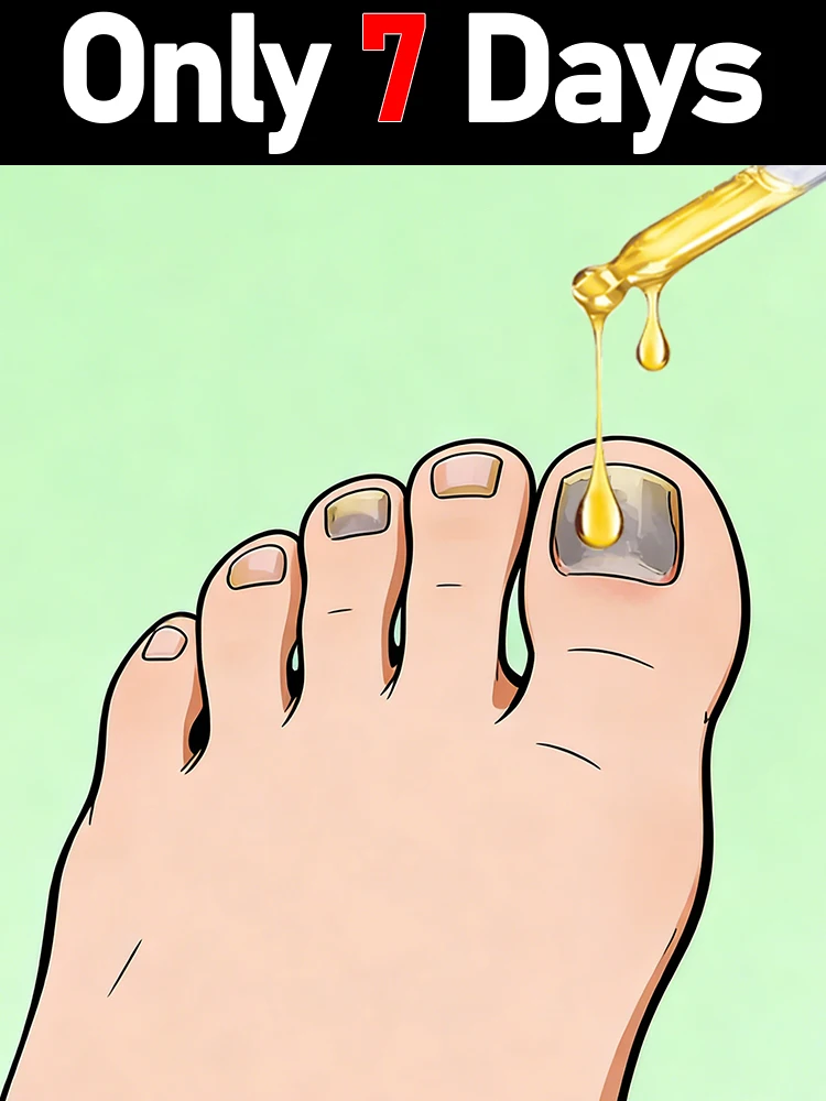 

Средство для восстановления ногтей, эффективно удаляет грибок ногтей на ногах, подходит для утолщенных, потускневших и серых ногтей.