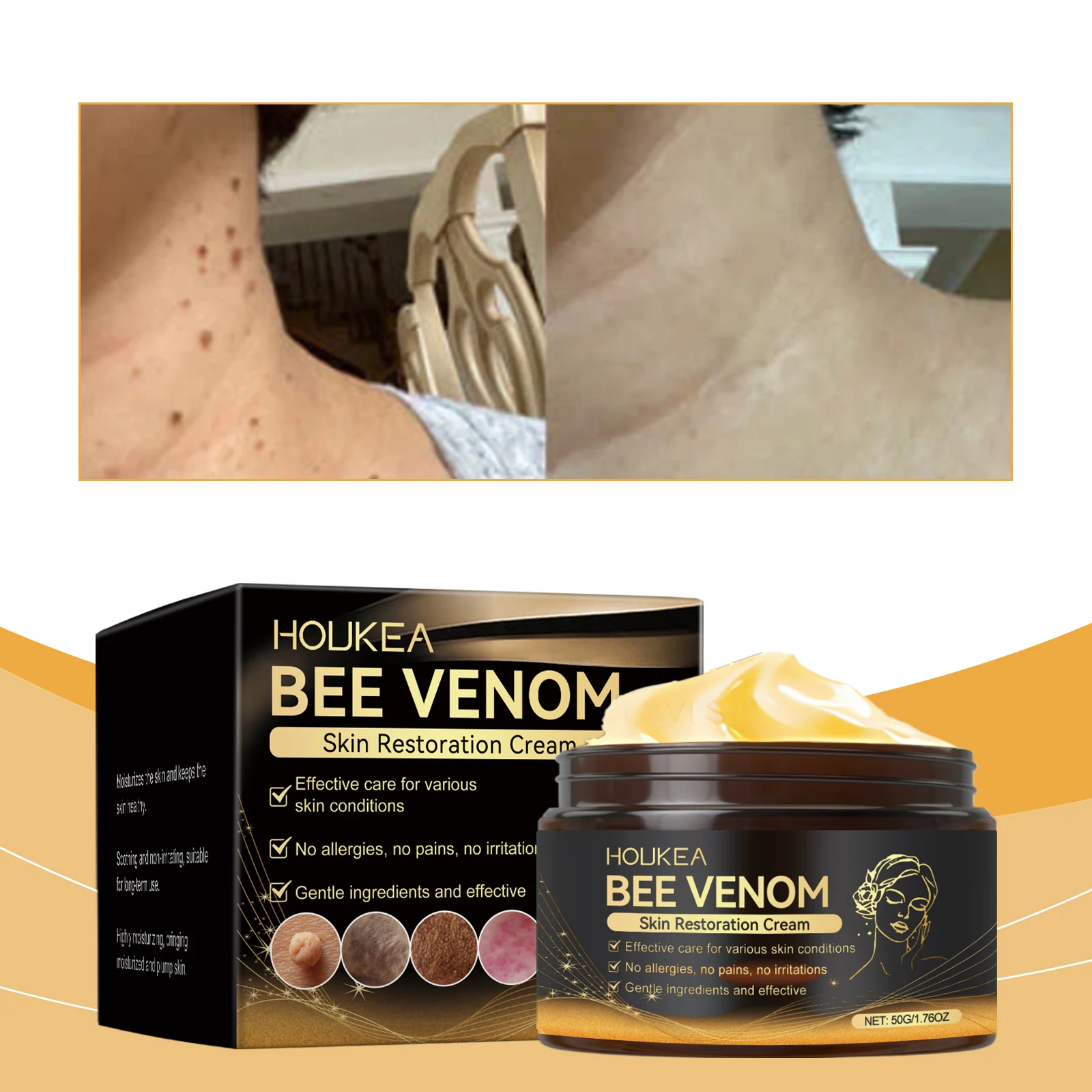 o-tratamento-de-reparo-da-pele-de-abelha-remove-a-pele-de-frango-reduz-a-secura-repara-acalma-nutre-hidrata-ilumina-a-tez