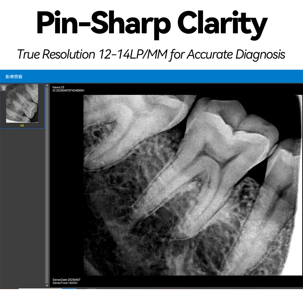 Portable Dental Xray RVG Sensor with Wireless X Ray Size 1/2 for Human & Animal 0.2s Fast Imaging