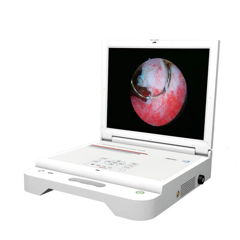 Fast Delivery Endoscope CCD Camera With Light Source and Portable Endoscopic Camera for ENT Surgery