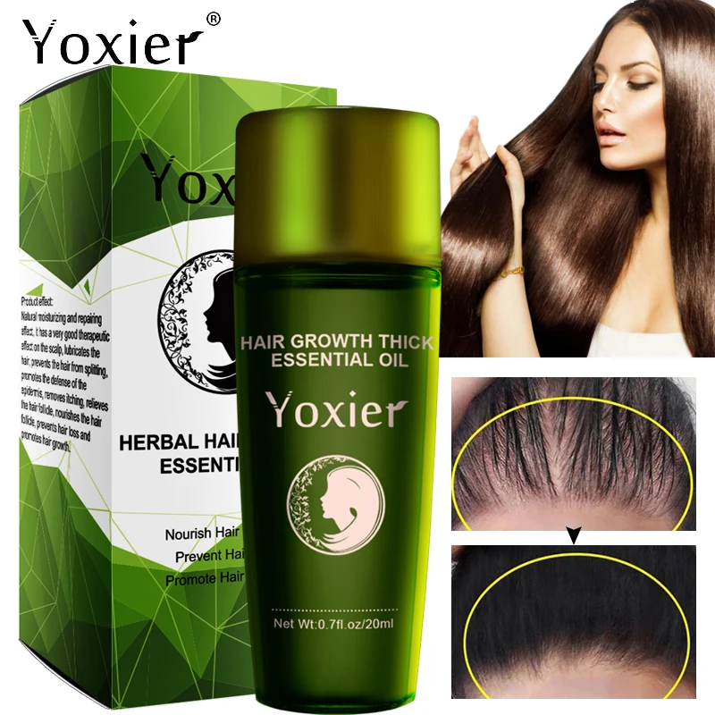 

Hair Growth Essence Oil Deep Nourishment Repair Hair Follicle Prevent Hair Loss Promote Hair Growth Anti-Drying Scalp Care 20ml