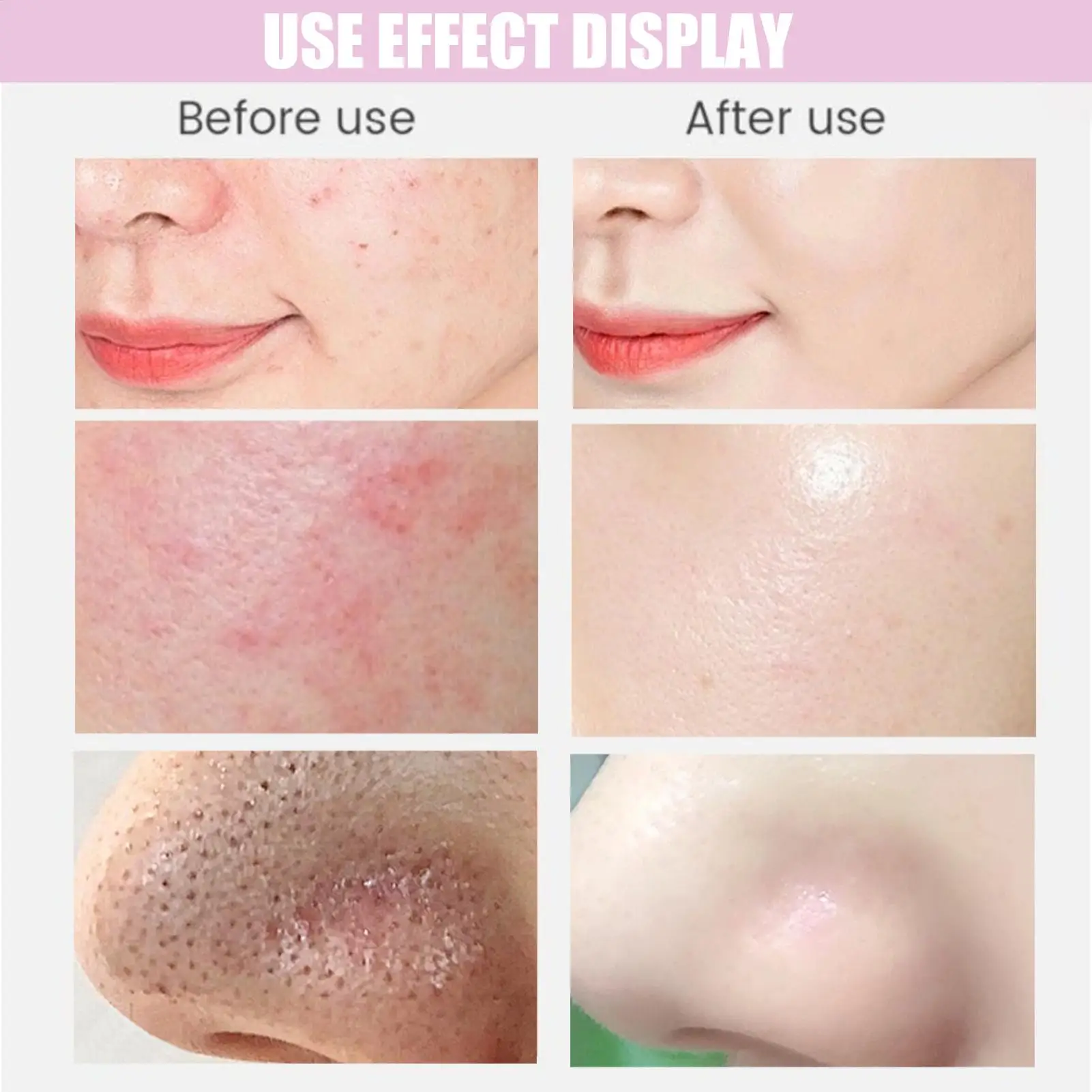 Gesichtsreinigungsbürste, Gesichtspeeling-Werkzeug mit 6 Bürstenköpfen, wiederaufladbares Hautpflege-Reinigungs- und Waschsystem für den Stirn des Körpers